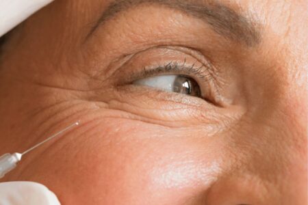 Toxine botulique (Botox) : indications, déroulement et résultats