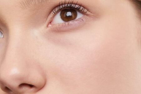 L&rsquo;acné adulte : solutions esthétiques et médicales